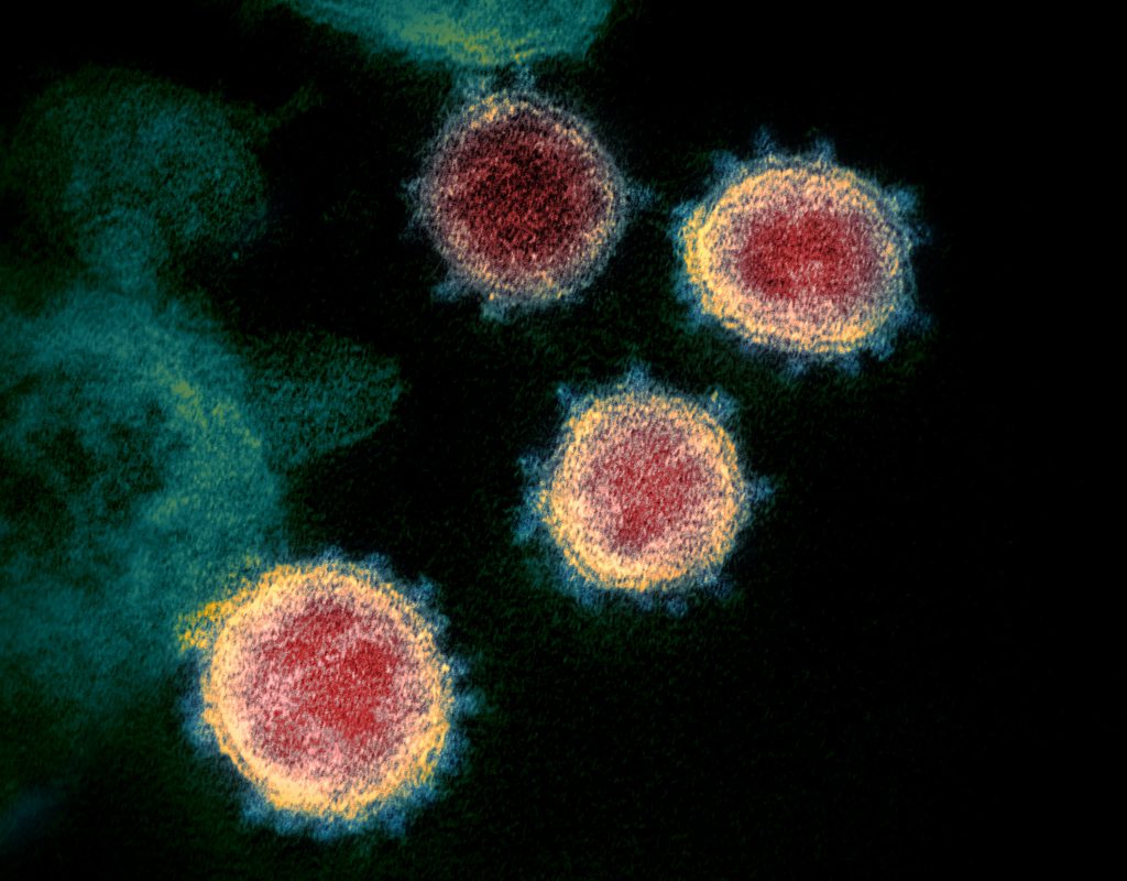 Corona-Virus – COVID-19 im Elektronenmikroskop